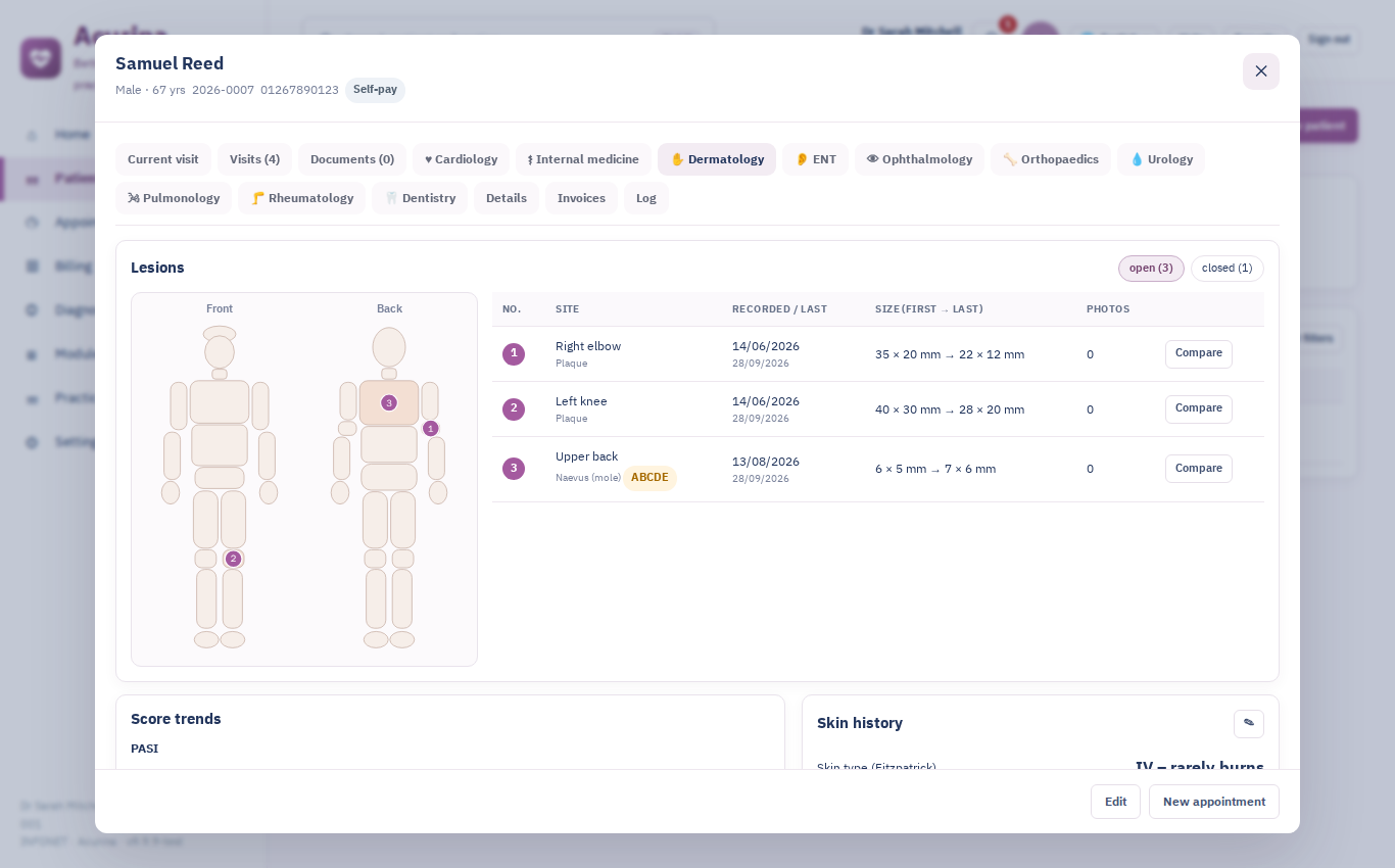 In the patient record